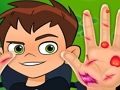 Игра Бен 10 лечит руки онлайн