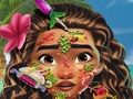 Игра Моана: Кожный доктор онлайн Игра Моана: Кожный доктор онлайн