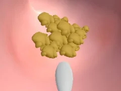 Игра Earwax Clinic онлайн