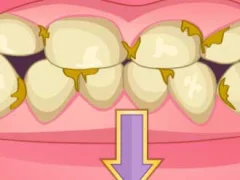 Игра Bad Teeth Makeover онлайн