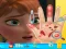 Игра Anna hand doctor онлайн