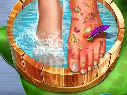 Игра Feet Skin Doctor онлайн