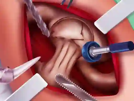 Игра Princess Hips Surgery онлайн