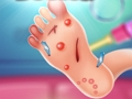 Игра Лечение ног онлайн