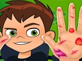 Игра Бен 10 лечит руки онлайн